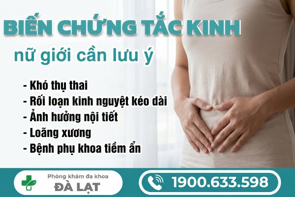 Hình ảnh minh họa
